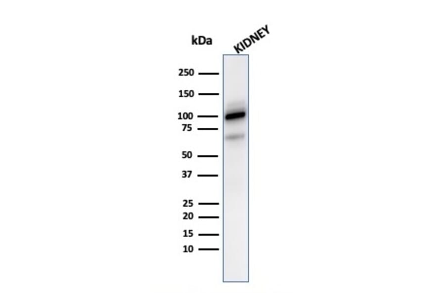 Western Blot - Anti-CD10 Antibody [MME/2590] - BSA and Azide free (A252539) - Antibodies.com