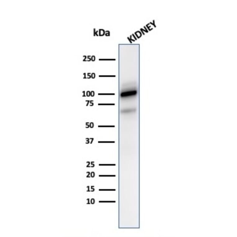 Western Blot - Anti-CD10 Antibody [MME/2590] - BSA and Azide free (A252539) - Antibodies.com