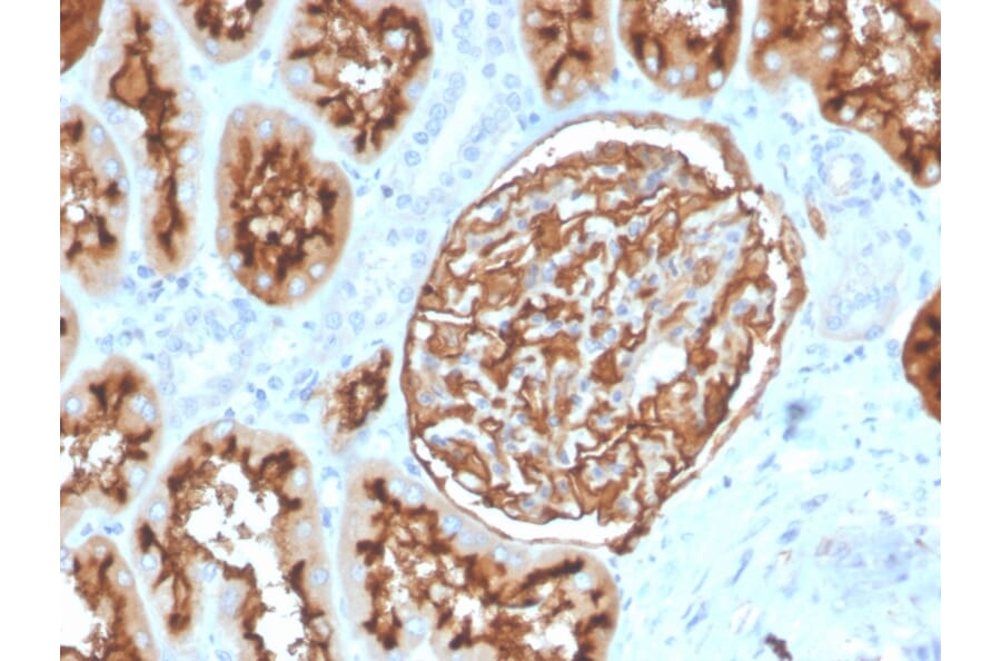 Immunohistochemistry - Anti-CD10 Antibody [MME/3739] - BSA and Azide free (A252540) - Antibodies.com