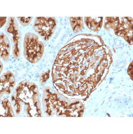 Immunohistochemistry - Anti-CD10 Antibody [MME/3739] - BSA and Azide free (A252540) - Antibodies.com