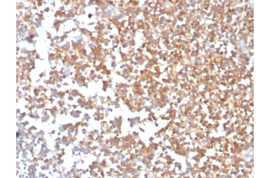 Immunohistochemistry - Anti-CD10 Antibody [MME/3739] - BSA and Azide free (A252540) - Antibodies.com