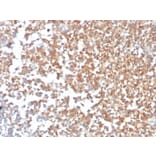 Immunohistochemistry - Anti-CD10 Antibody [MME/3739] - BSA and Azide free (A252540) - Antibodies.com