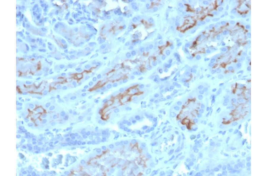 Immunohistochemistry - Anti-CD10 Antibody [MME/4232] - BSA and Azide free (A252542) - Antibodies.com