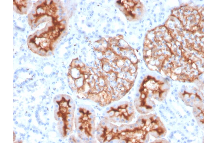 Immunohistochemistry - Anti-CD10 Antibody [MME/4235] - BSA and Azide free (A252544) - Antibodies.com