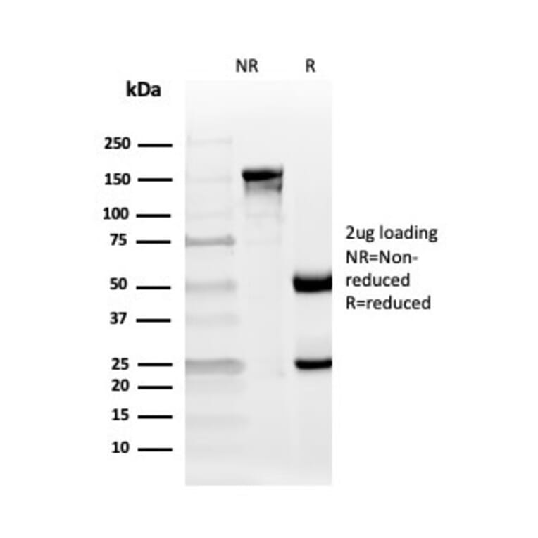 SDS-PAGE - Anti-CD10 Antibody [MME/4235] - BSA and Azide free (A252544) - Antibodies.com