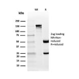 SDS-PAGE - Anti-CD10 Antibody [MME/4235] - BSA and Azide free (A252544) - Antibodies.com