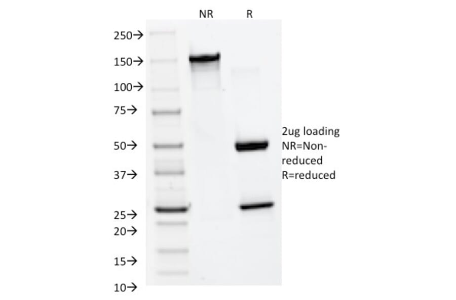 SDS-PAGE - Anti-MMP2 Antibody [MMP2/1501] - BSA and Azide free (A252546) - Antibodies.com