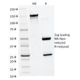 SDS-PAGE - Anti-MMP2 Antibody [MMP2/1501] - BSA and Azide free (A252546) - Antibodies.com