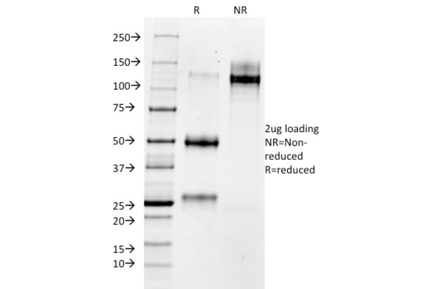 SDS-PAGE - Anti-MMP3 Antibody [1B4] - BSA and Azide free (A252546) - Antibodies.com