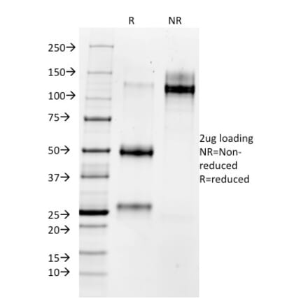 SDS-PAGE - Anti-MMP3 Antibody [1B4] - BSA and Azide free (A252546) - Antibodies.com
