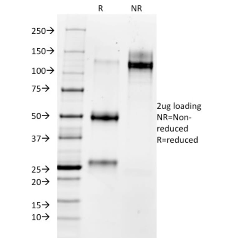 SDS-PAGE - Anti-MMP3 Antibody [MMP3/1730] - BSA and Azide free (A252547) - Antibodies.com