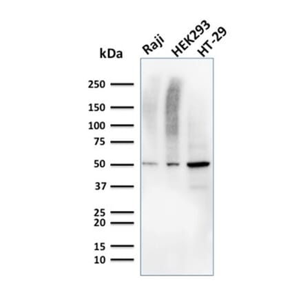 Western Blot - Anti-MMP3 Antibody [MMP3/2655] - BSA and Azide free (A252550) - Antibodies.com