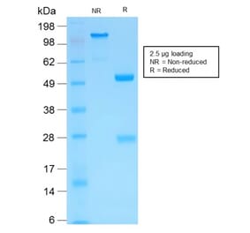 SDS-PAGE - Anti-MMP3 Antibody [MMP3/1994R] - BSA and Azide free (A252551) - Antibodies.com