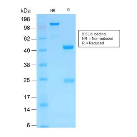 SDS-PAGE - Anti-MMP3 Antibody [MMP3/1994R] - BSA and Azide free (A252551) - Antibodies.com