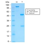SDS-PAGE - Anti-MMP3 Antibody [MMP3/1994R] - BSA and Azide free (A252551) - Antibodies.com