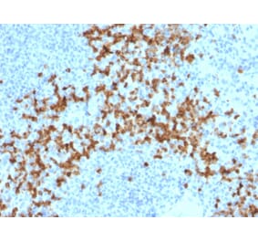 Immunohistochemistry - Anti-MMP9 Antibody [2C3] - BSA and Azide free (A252552) - Antibodies.com
