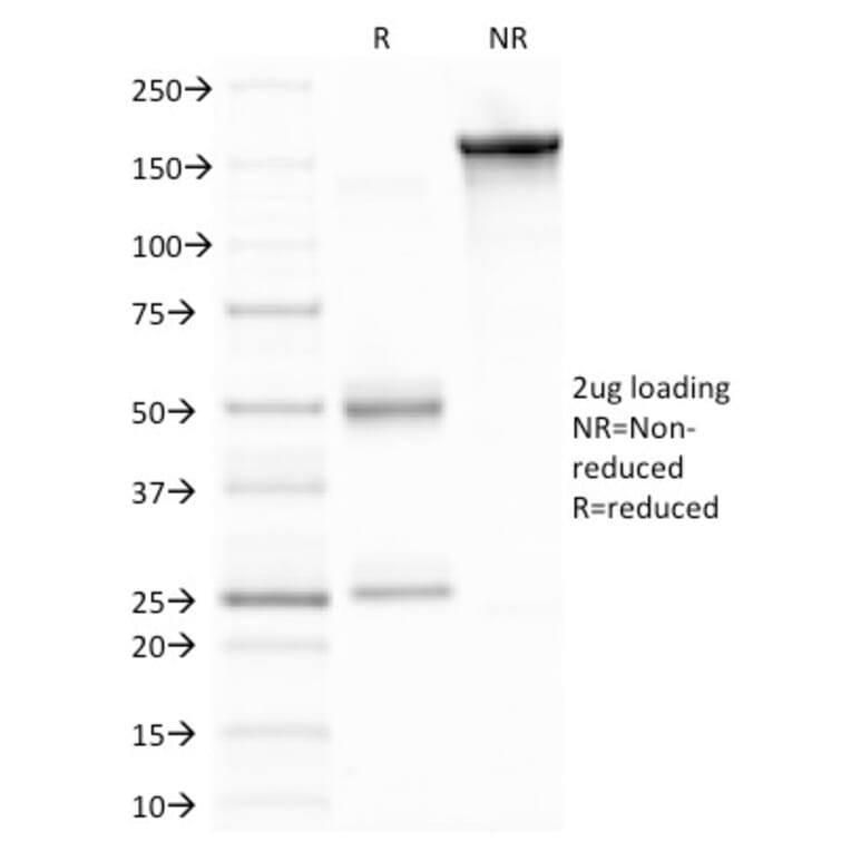 SDS-PAGE - Anti-MMP9 Antibody [2C3] - BSA and Azide free (A252553) - Antibodies.com