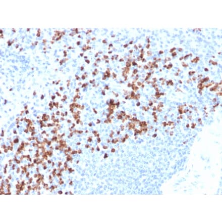 Immunohistochemistry - Anti-MMP9 Antibody [rMMP9/1769] - BSA and Azide free (A252553) - Antibodies.com