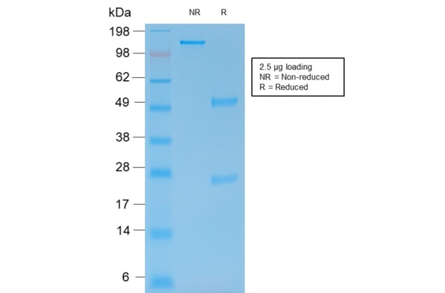 SDS-PAGE - Anti-MMP9 Antibody [rMMP9/1769] - BSA and Azide free (A252554) - Antibodies.com