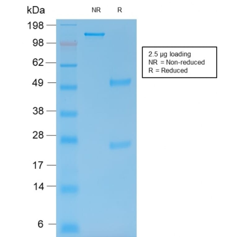 SDS-PAGE - Anti-MMP9 Antibody [rMMP9/1769] - BSA and Azide free (A252554) - Antibodies.com