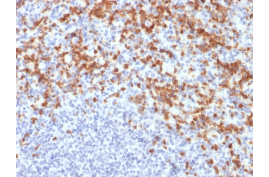 Immunohistochemistry - Anti-MMP9 Antibody [MMP9/2477] - BSA and Azide free (A252554) - Antibodies.com