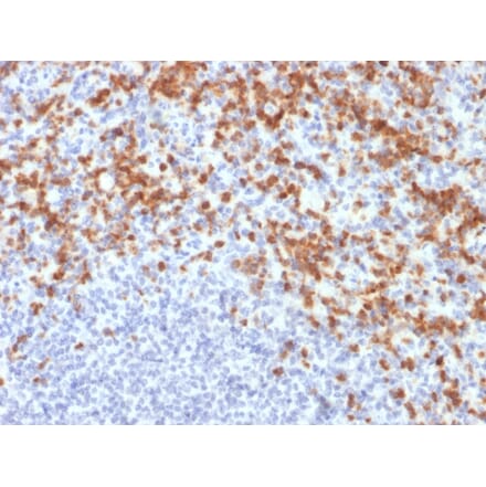 Immunohistochemistry - Anti-MMP9 Antibody [MMP9/2477] - BSA and Azide free (A252554) - Antibodies.com