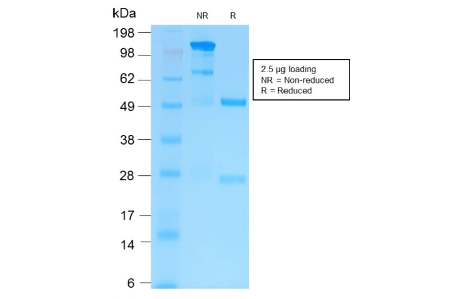 SDS-PAGE - Anti-MMP9 Antibody [MMP9/2025R] - BSA and Azide free (A252557) - Antibodies.com