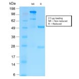 SDS-PAGE - Anti-MMP9 Antibody [MMP9/2025R] - BSA and Azide free (A252557) - Antibodies.com