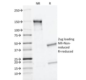 SDS-PAGE - Anti-MRP1 Antibody [MRP1/1343] - BSA and Azide free (A252557) - Antibodies.com