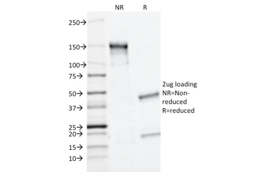 SDS-PAGE - Anti-MRP1 Antibody [MRP1/1343] - BSA and Azide free (A252557) - Antibodies.com