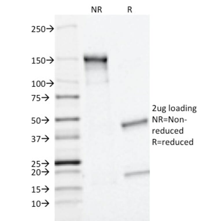 SDS-PAGE - Anti-MRP1 Antibody [MRP1/1343] - BSA and Azide free (A252557) - Antibodies.com