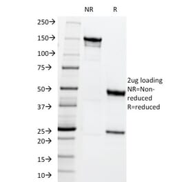 SDS-PAGE - Anti-MRP1 Antibody [MRP1/1344] - BSA and Azide free (A252558) - Antibodies.com