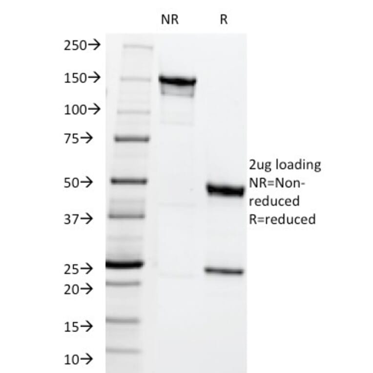 SDS-PAGE - Anti-MRP1 Antibody [MRP1/1344] - BSA and Azide free (A252558) - Antibodies.com