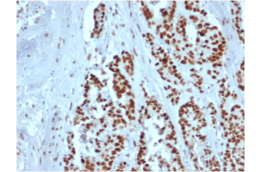 Immunohistochemistry - Anti-MSH2 Antibody [rMSH2/6548] - BSA and Azide free (A252560) - Antibodies.com