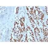 Immunohistochemistry - Anti-MSH2 Antibody [rMSH2/6548] - BSA and Azide free (A252560) - Antibodies.com