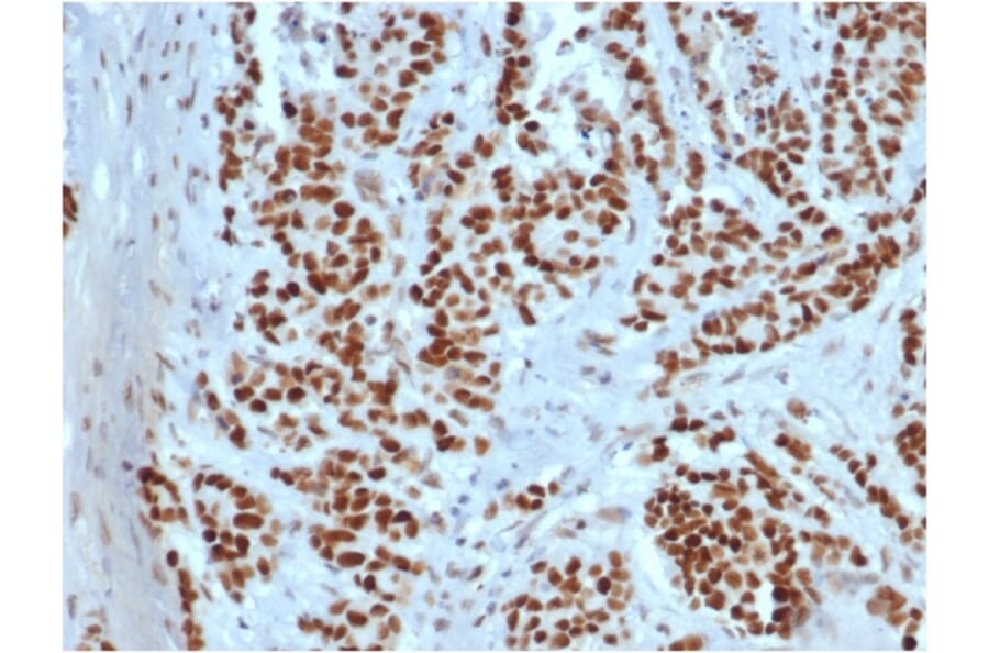 Immunohistochemistry - Anti-MSH2 Antibody [rMSH2/6548] - BSA and Azide free (A252559) - Antibodies.com