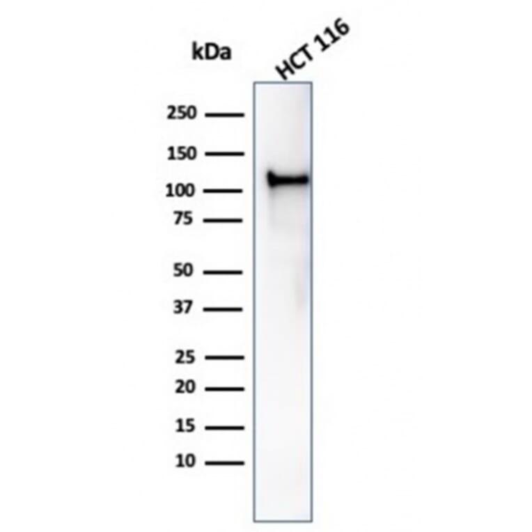 Western Blot - Anti-MSH2 Antibody [rMSH2/6548] - BSA and Azide free (A252560) - Antibodies.com