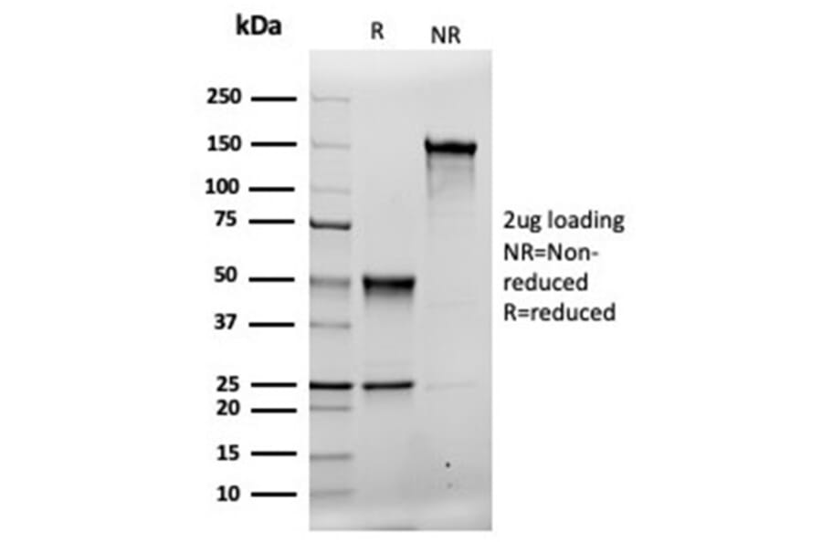 SDS-PAGE - Anti-MSH2 Antibody [rMSH2/6548] - BSA and Azide free (A252560) - Antibodies.com