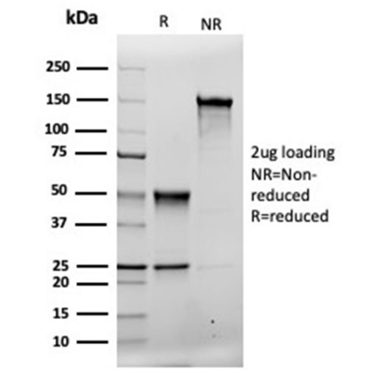SDS-PAGE - Anti-MSH2 Antibody [rMSH2/6548] - BSA and Azide free (A252560) - Antibodies.com