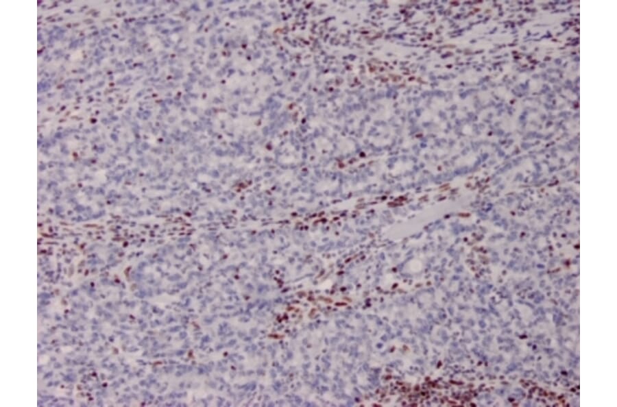 Immunohistochemistry - Anti-MSH2 Antibody [MSH2/2622] - BSA and Azide free (A252561) - Antibodies.com
