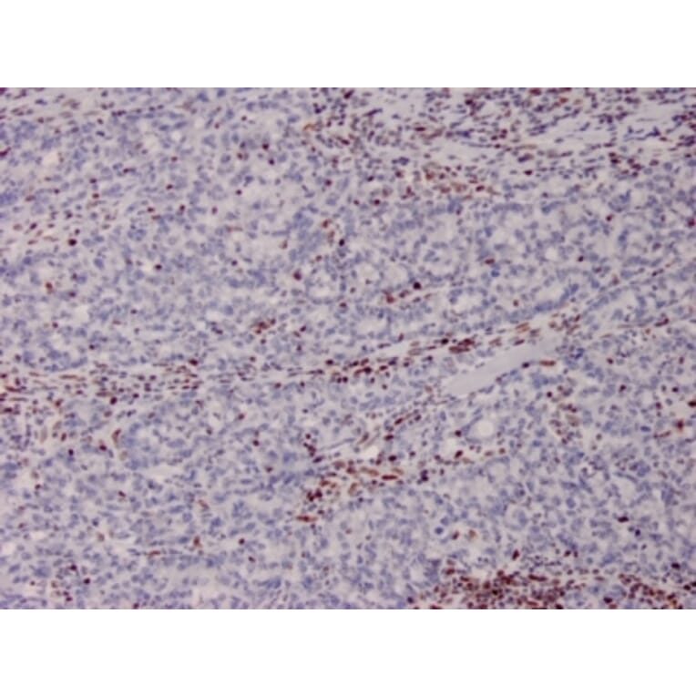 Immunohistochemistry - Anti-MSH2 Antibody [MSH2/2622] - BSA and Azide free (A252561) - Antibodies.com