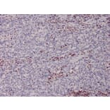 Immunohistochemistry - Anti-MSH2 Antibody [MSH2/2622] - BSA and Azide free (A252561) - Antibodies.com