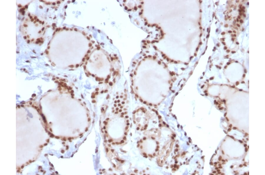 Immunohistochemistry - Anti-MSH2 Antibody [MSH2/2622] - BSA and Azide free (A252561) - Antibodies.com