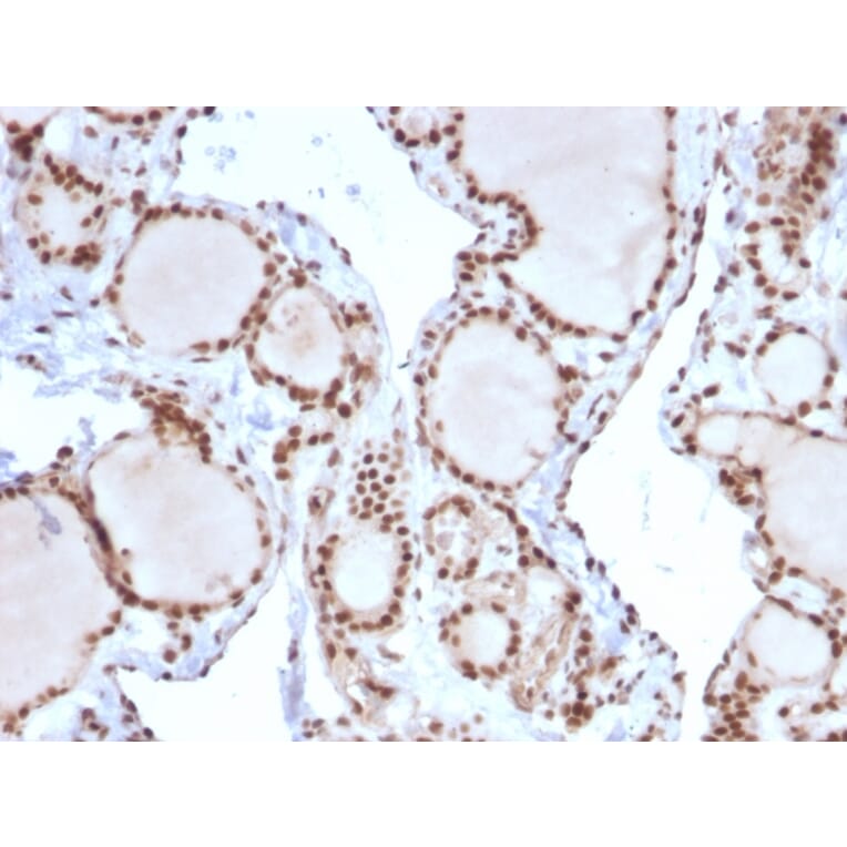 Immunohistochemistry - Anti-MSH2 Antibody [MSH2/2622] - BSA and Azide free (A252561) - Antibodies.com