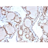 Immunohistochemistry - Anti-MSH2 Antibody [MSH2/2622] - BSA and Azide free (A252561) - Antibodies.com