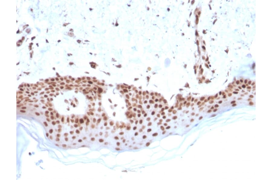 Immunohistochemistry - Anti-MSH2 Antibody [MSH2/2622] - BSA and Azide free (A252561) - Antibodies.com