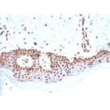 Immunohistochemistry - Anti-MSH2 Antibody [MSH2/2622] - BSA and Azide free (A252561) - Antibodies.com