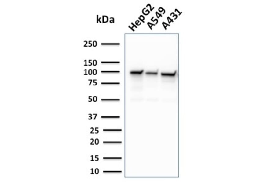 Western Blot - Anti-MSH2 Antibody [MSH2/2622] - BSA and Azide free (A252561) - Antibodies.com