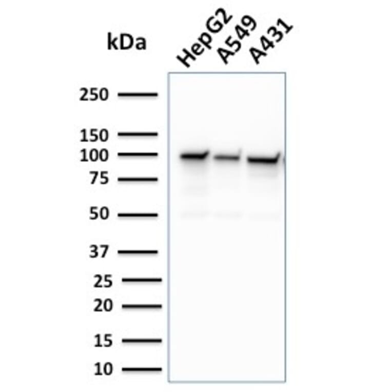 Western Blot - Anti-MSH2 Antibody [MSH2/2622] - BSA and Azide free (A252561) - Antibodies.com