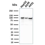 Western Blot - Anti-MSH2 Antibody [MSH2/2622] - BSA and Azide free (A252561) - Antibodies.com